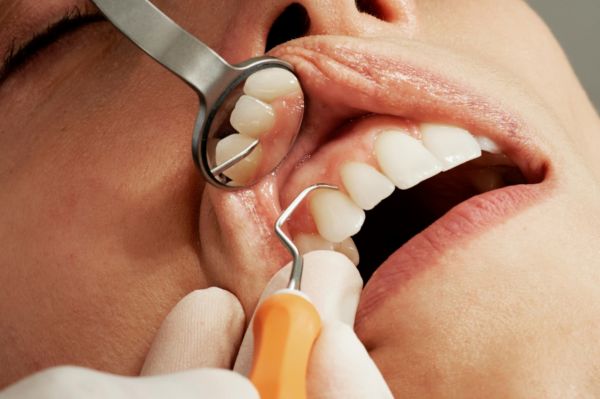 Kostenschock beim Zahnarzt vermeiden
